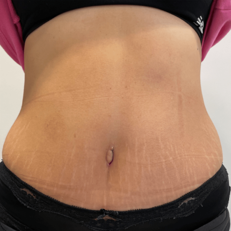AFTER 5 WEEKS